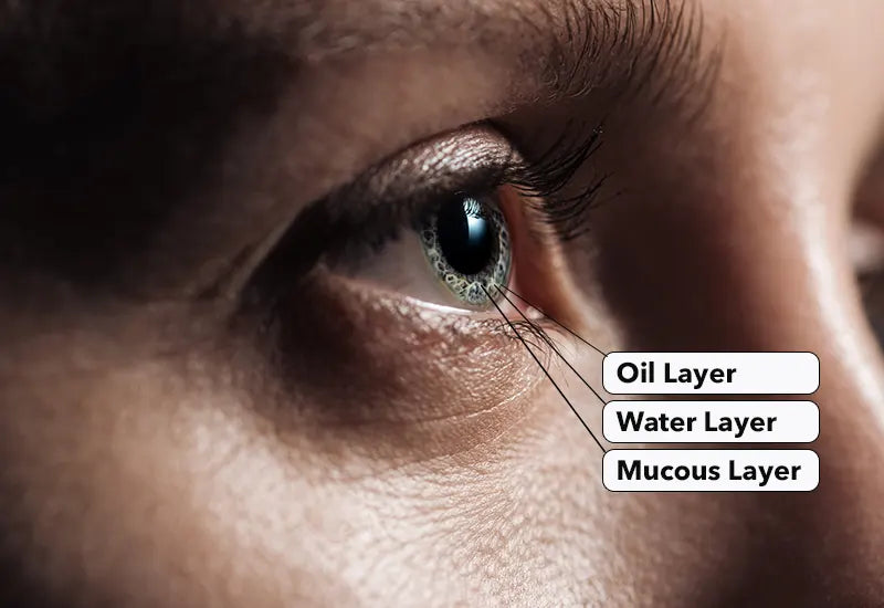 image comparison after