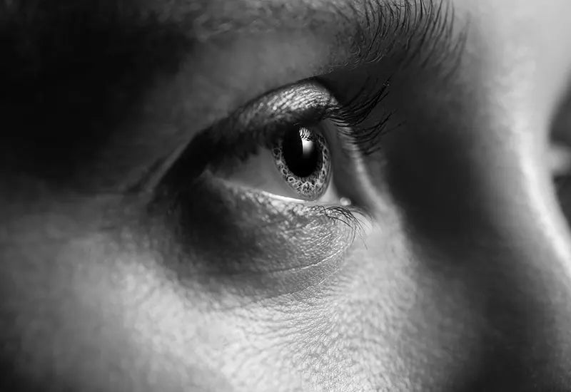 image comparison before